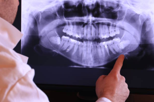Best Broken Tooth Emergency  in Gypsum, CO